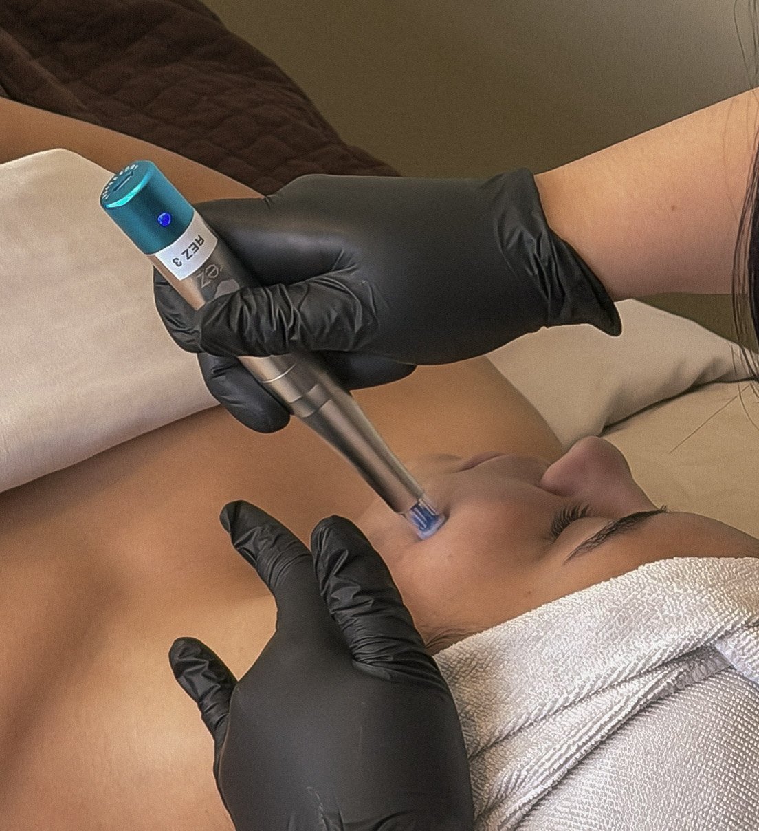 Advanced Skincare Redefined: The Benefits of Rezenerate Nano Infusion