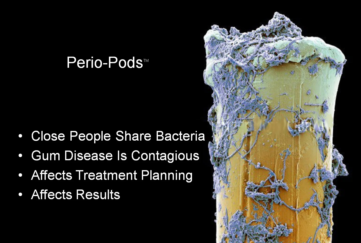 perio pods.jpg