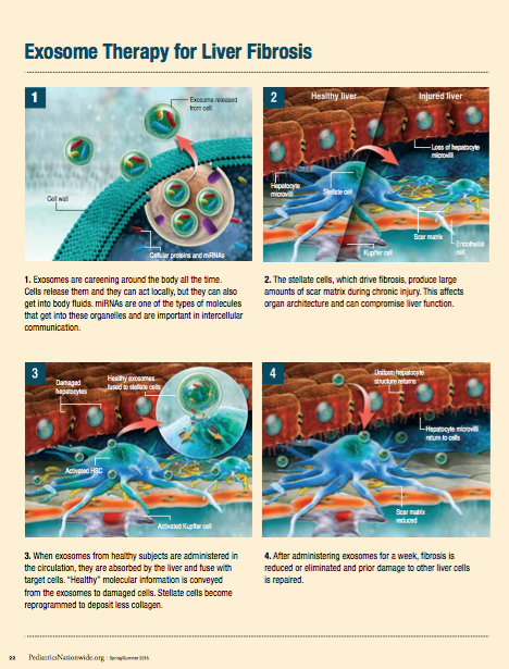 Fibrosis Narration PN.png