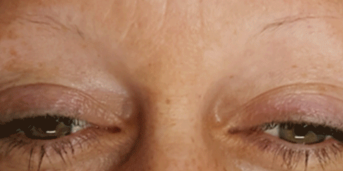 Before-After1.gif