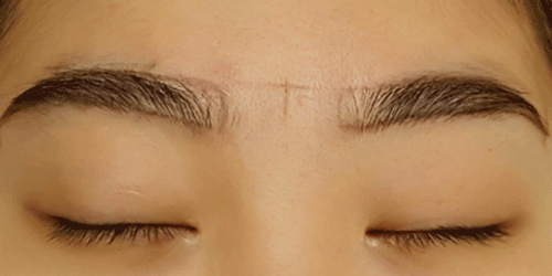 Before-After2.gif