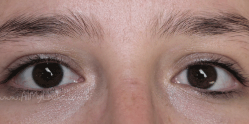Before-After3.gif