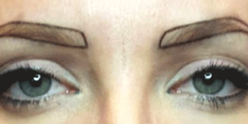 Before-After4.gif