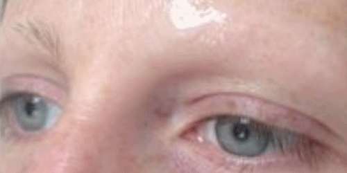 Before-After8.gif