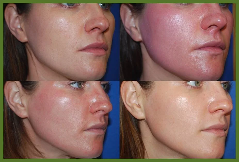 Photo Credit: Robertson Cosmetic Center 