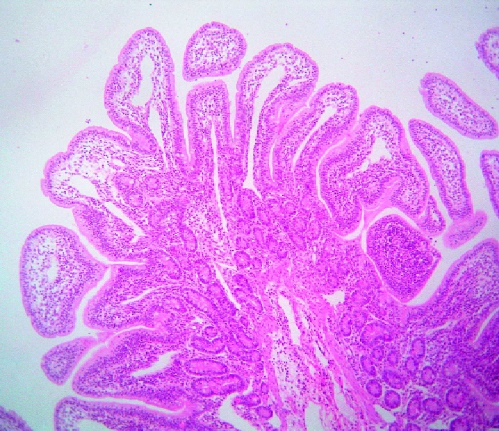 Lymphocyte Response during Inflammation