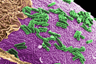 The human microbiome
