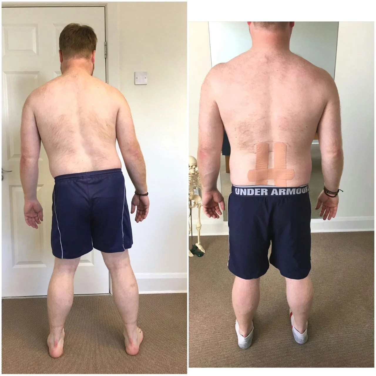 Standing Observations (Before/After) 