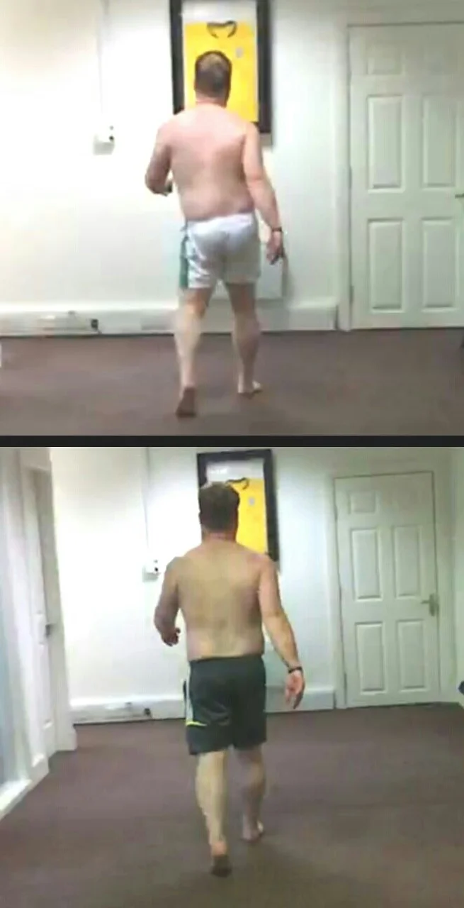 Phase 2. Left Propulsion (toe off) and Right Suspension (foot Pronation) - Coupled movement Before / After