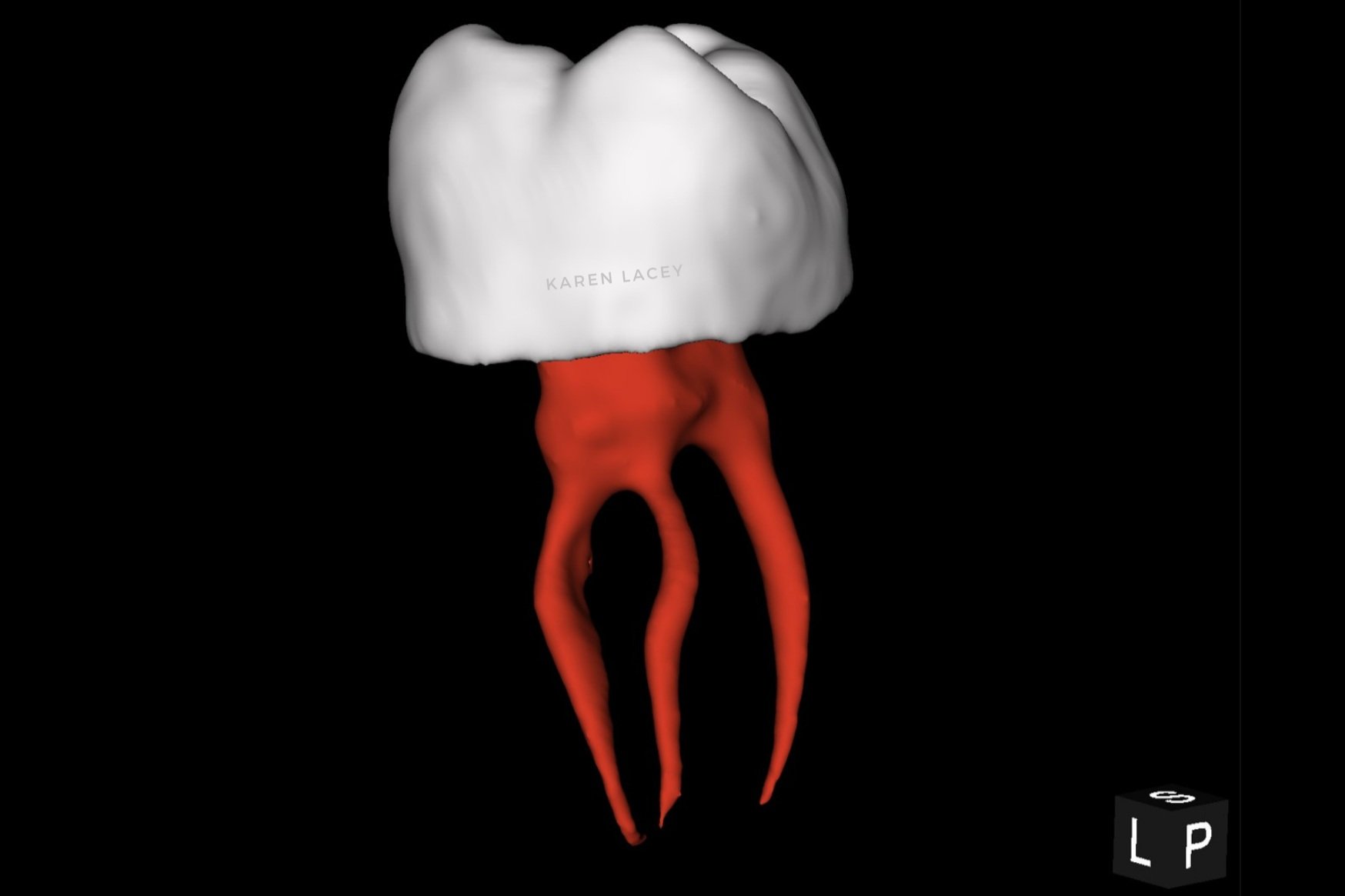 Tooth.jpg
