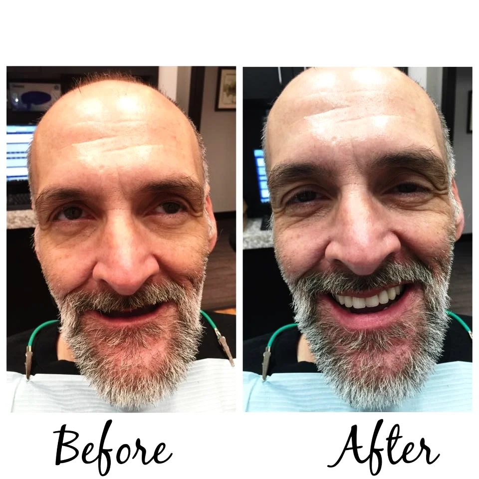 Before and After 2 for Yelp.jpg