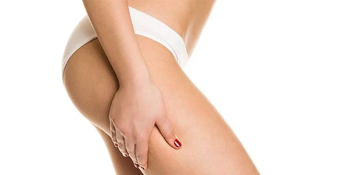 heavy cellulite thighs