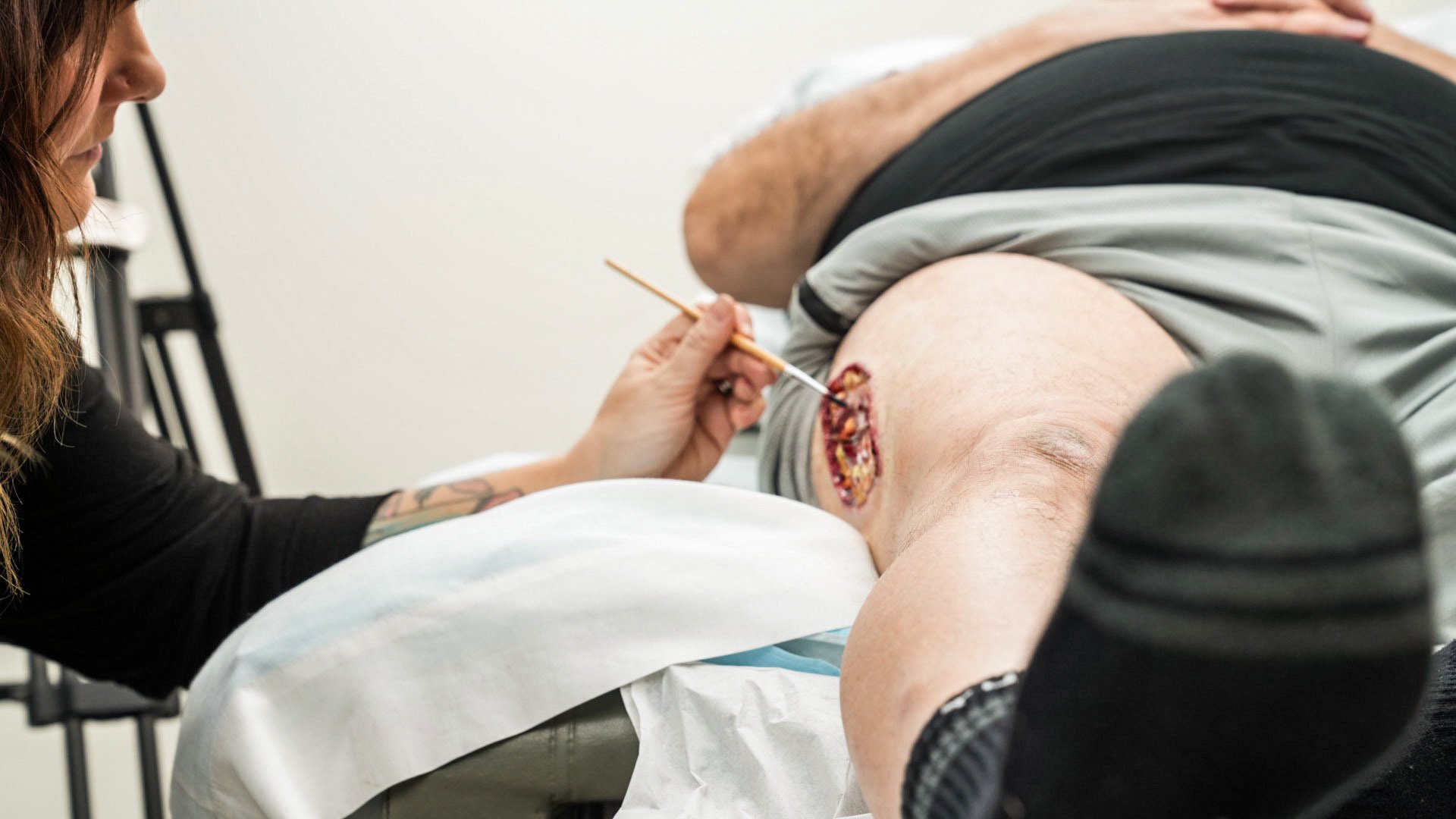 Open Wound for 3M Medical 