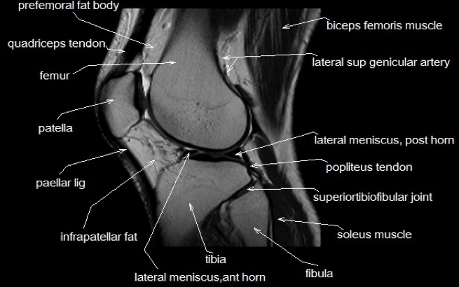 Parts of a knee