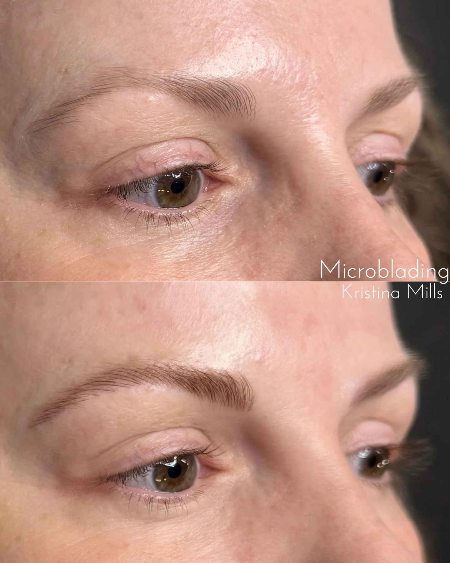 The goal with microblading isn&rsquo;t to create something completely new&mdash;it&rsquo;s to gently fill in what&rsquo;s already there and bring a little more balance to the face.

You can see here how subtle the difference is&hellip; but also how m