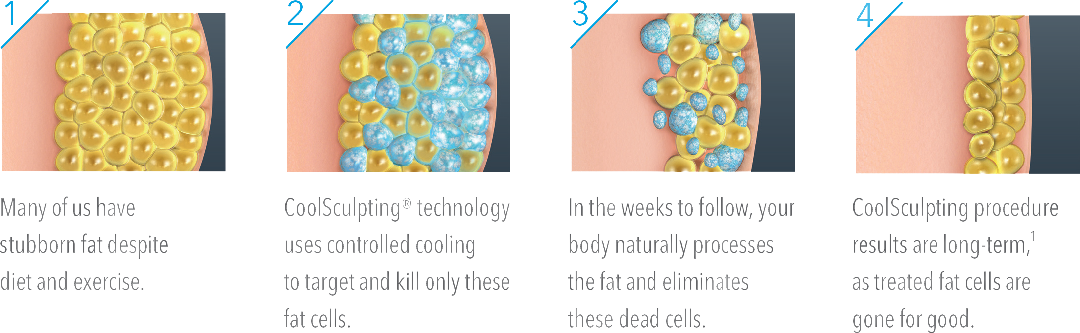 Infinity MedSpa + Wellness CoolSculpting.png