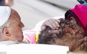 Pope Francis Healing Touch