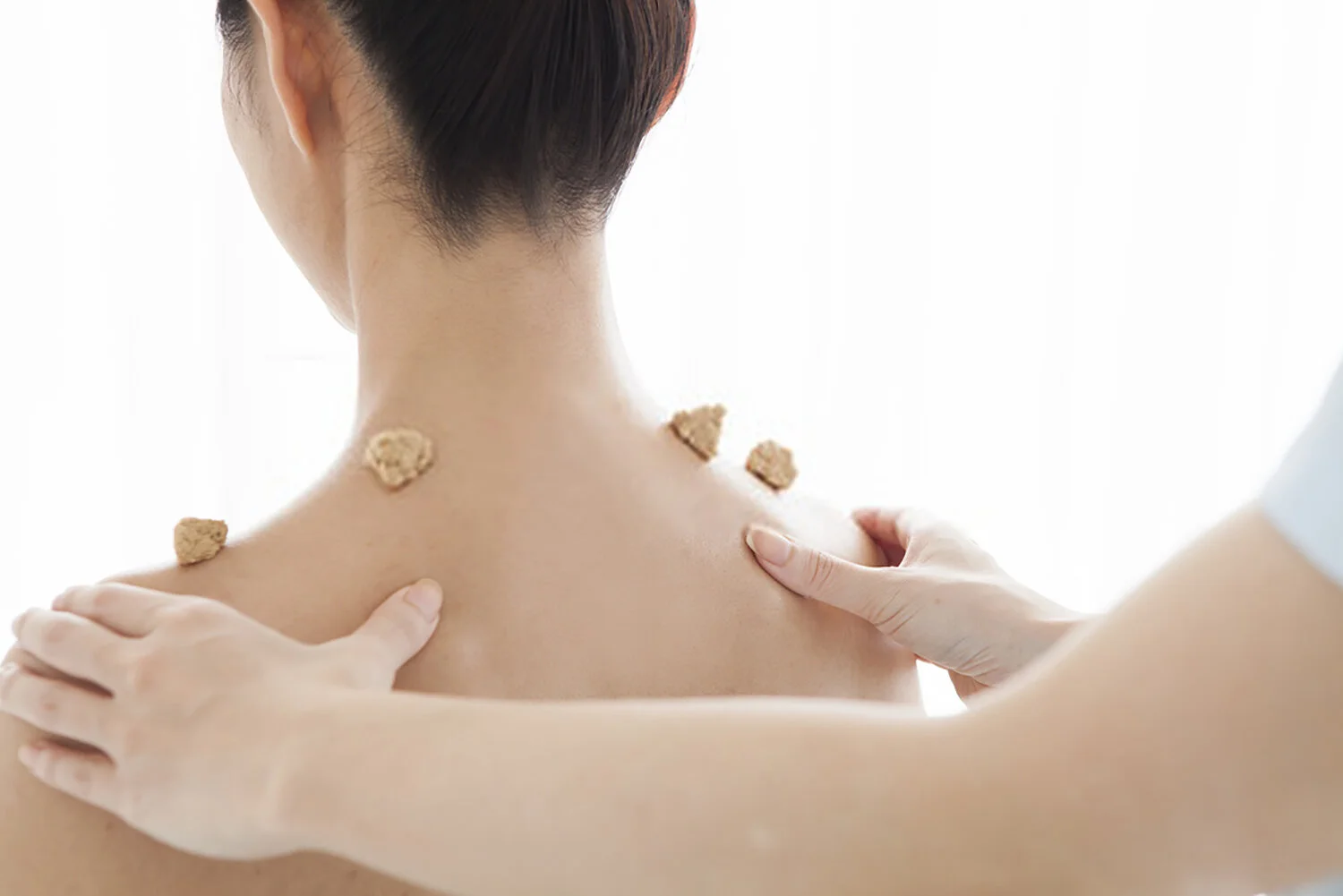San Fu Moxibustion: When and why to do it. 