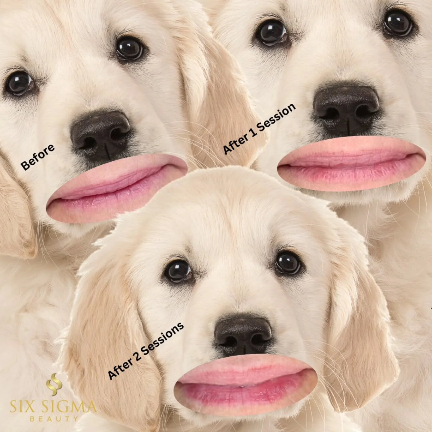 Tired of dry, thinning lips?

Our Lips Renewed treatment uses controlled laser energy on the lips to rebuild collagen, enhance definition, and restore youthful plumpness. This is a great option for clients who want a natural approach without needles.