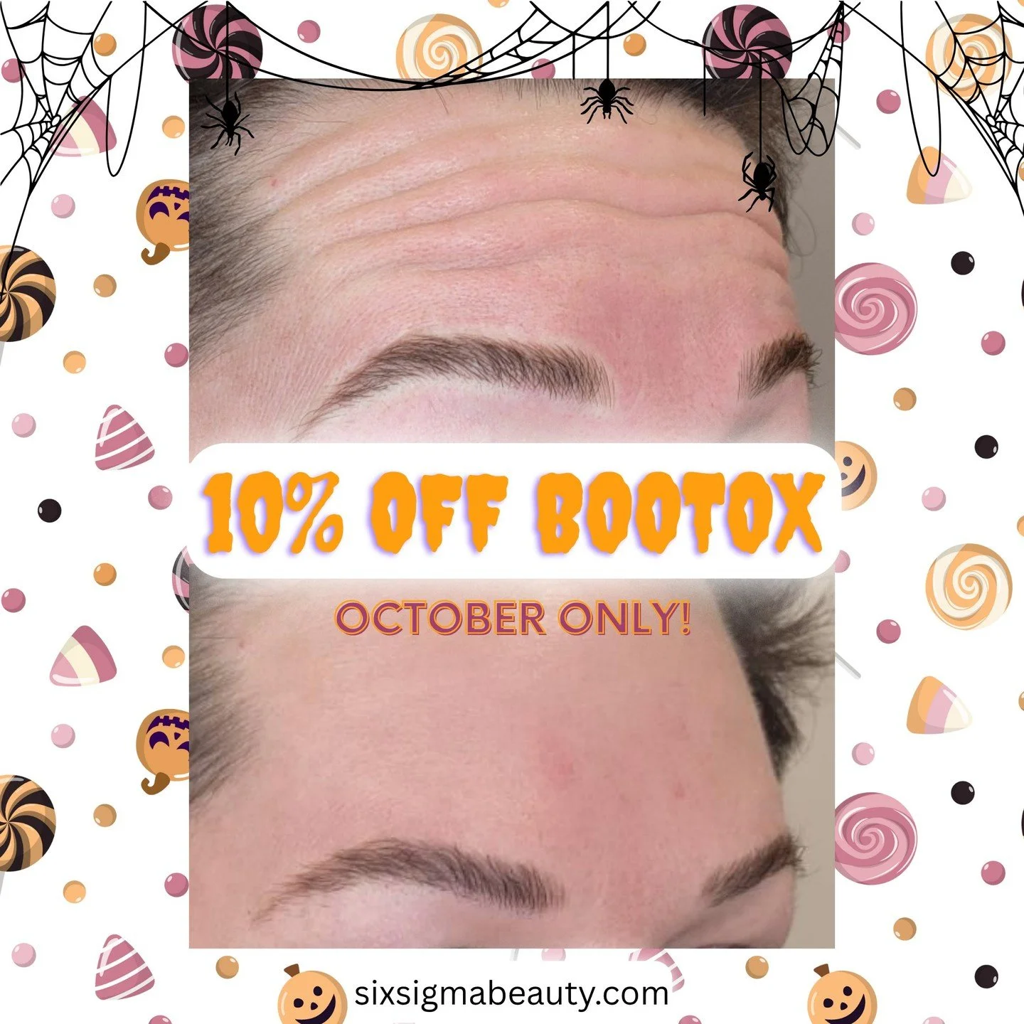 Hey BOO! It's time to ghost wrinkles! Treat yourself to 10% OFF BooTox all month long! Call (860) 202-2815 or book your Dysport appointment at sixsigmabeauty.com. See you soon! 👻
