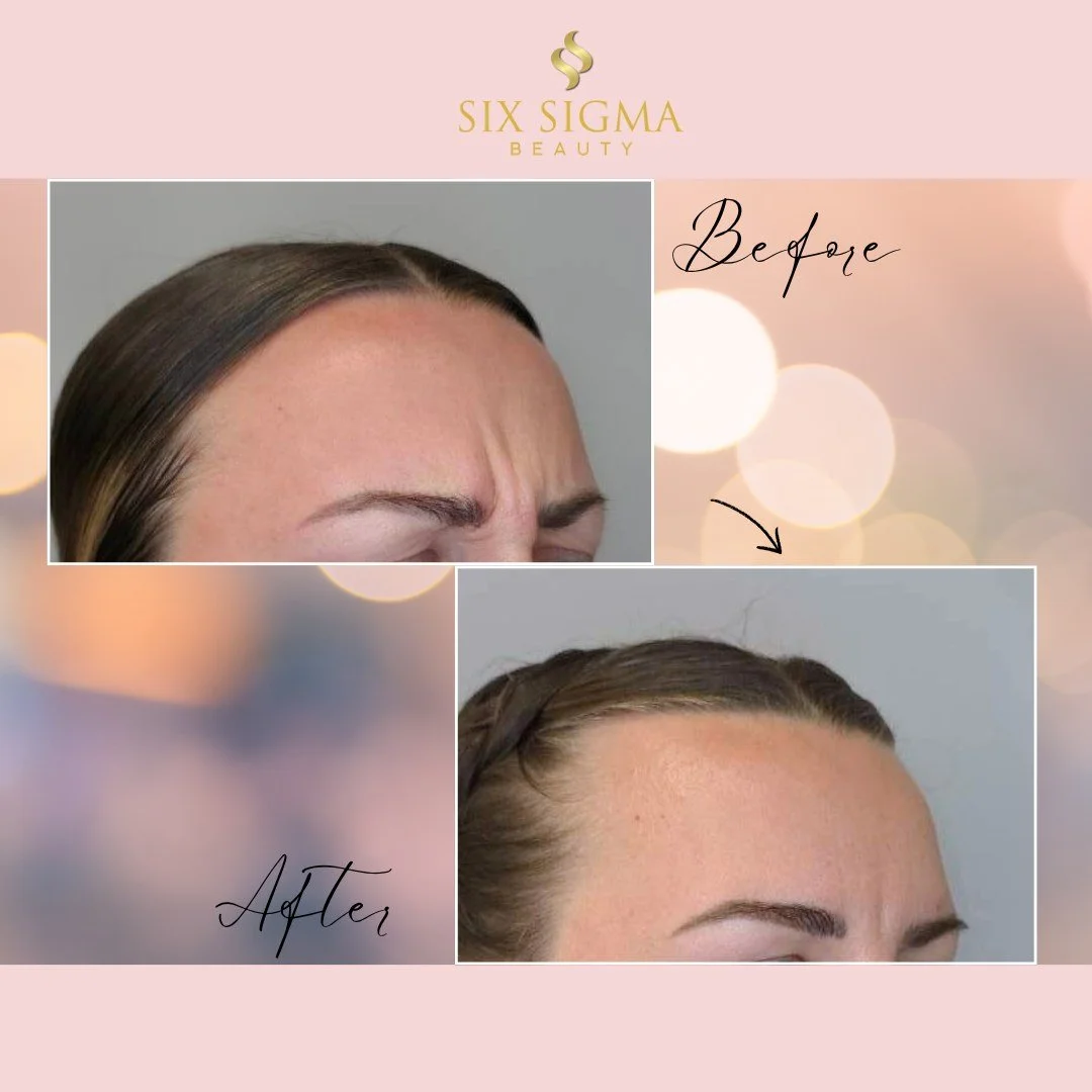 Cheers to smoother holiday selfies. Thanks Dysport! 😘📸

Easy online booking at sixsigmabeauty.com or call (860) 202-2815.

⭐⭐⭐⭐⭐
SIX SIGMA BEAUTY
Boutique Medspa
316 North Main Street, Suite 2, Southington CT
(860) 202-2815
sixsigmabeauty.com