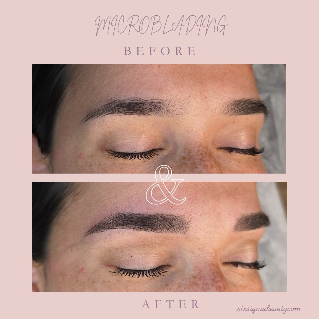 When the canvas is already beautiful, we simply enhance the details. For this client, microblading was used to add subtle fullness and sharpen the definition. Our ultimate goal is to create a look that is natural for YOU, always.
