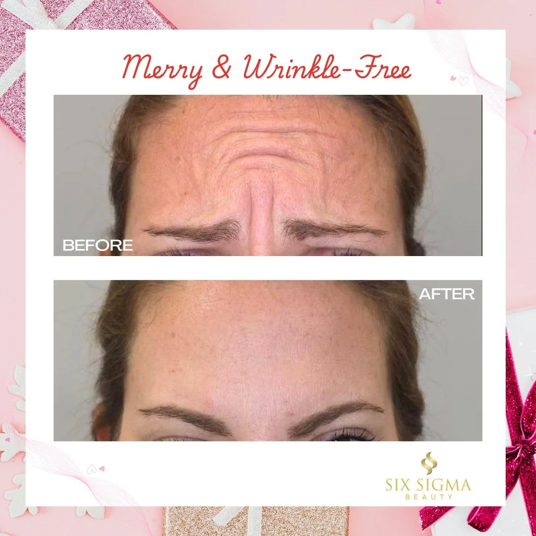 Lines? Not on her Christmas list 🎄❌ 

⭐⭐⭐⭐⭐
SIX SIGMA BEAUTY
Boutique Medspa
Southington, CT
(860) 202-2815
sixsigmabeauty.com