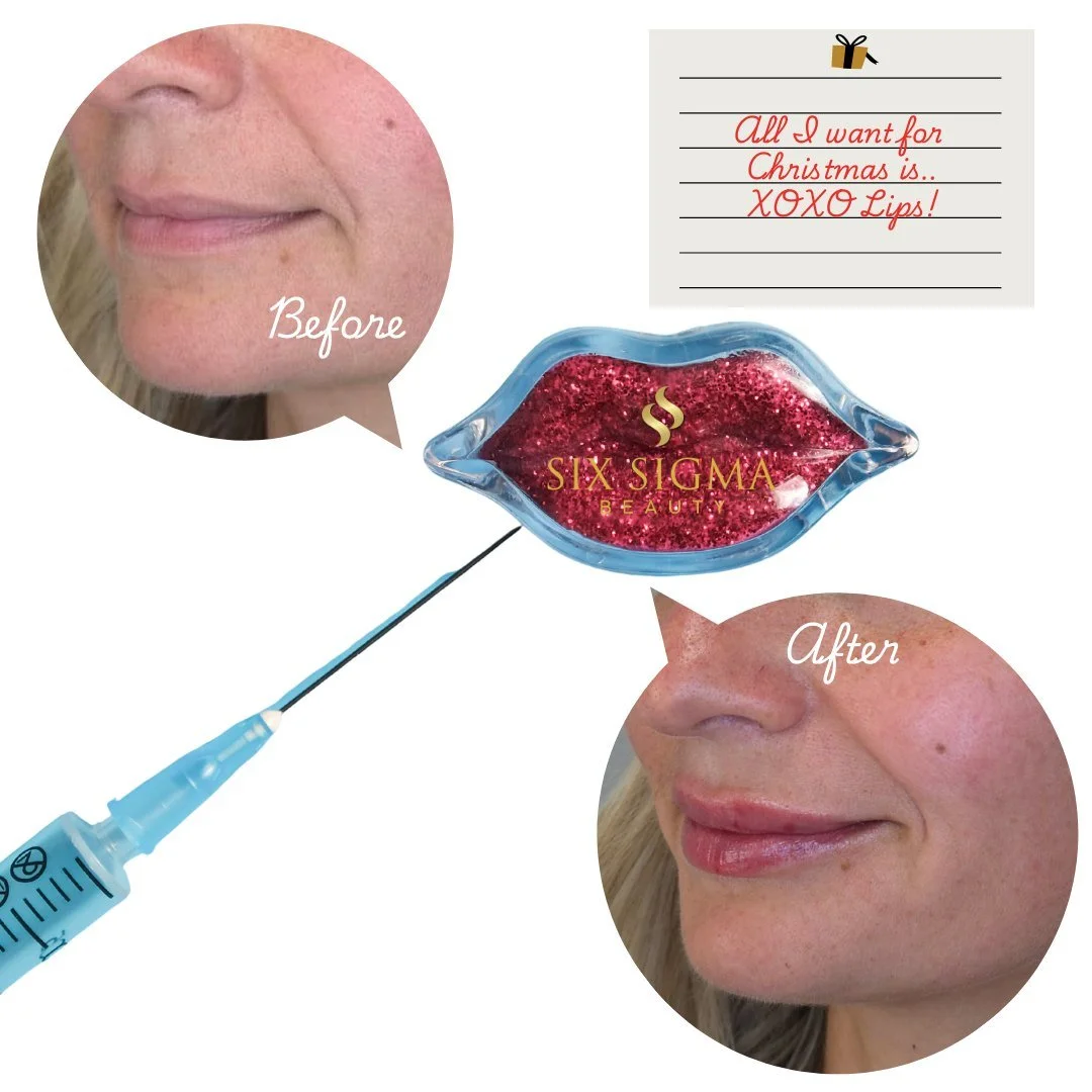 Lips that whisper, not shout 💋

This is before and immediately after the XOXO Lip Filler treatment. Swelling, and bruising are normal during your healing phase. Please plan your treatment in advance of any special events!