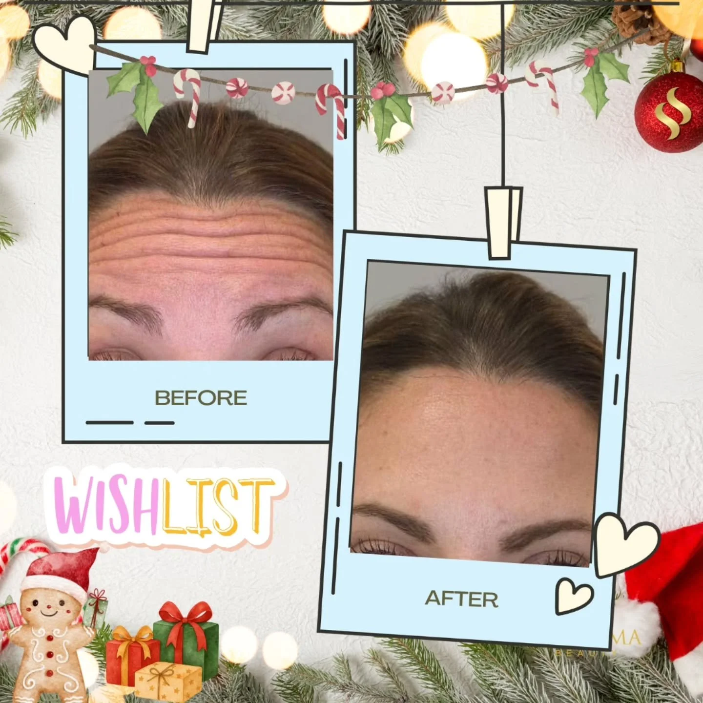 Dear Santa, she doesn't want gifts. She wants RESULTS.

P.S. There&rsquo;s an extra cookie with your name on it! 🍪✨

20% OFF E-Gift Cards purchase => link in bio

⭐️⭐️⭐️⭐️⭐️
SIX SIGMA BEAUTY 
Boutique Medspa
(860) 202-2815 
sixsigmabeauty.com