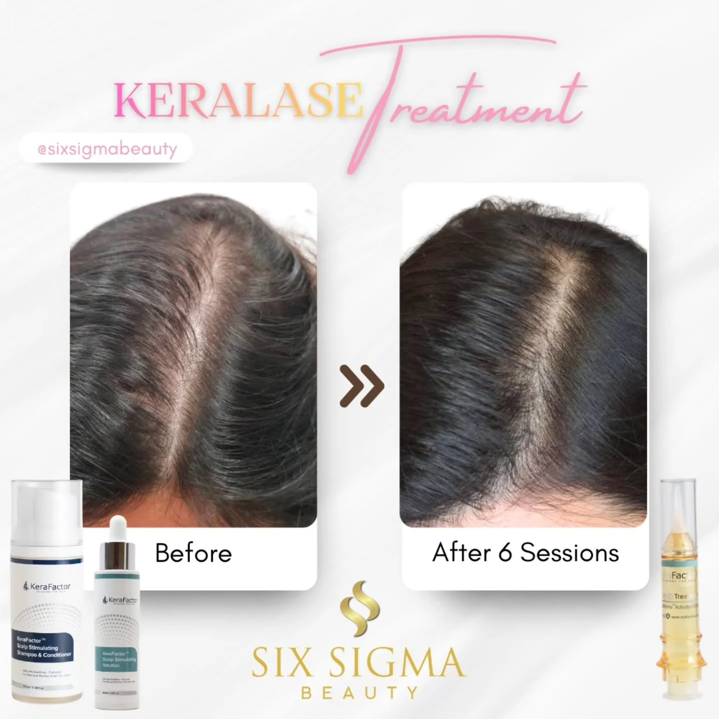 She said nothing&hellip; but her hair told EVERYTHING ☕️👀

6 Keralase treatments + major at-home consistency =
✨ Thicker hair
✨ More volume
✨ Healthier scalp

She kept it hush for 6 months until her stylist after treatment #5 said:

&ldquo;Your hair