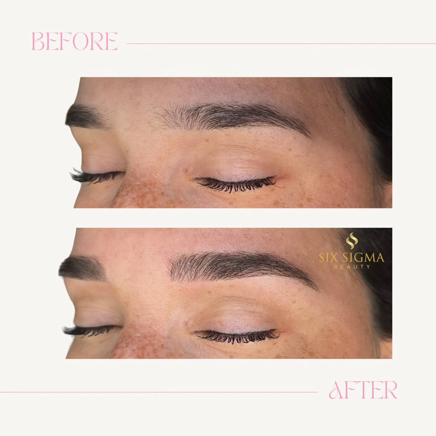 Before &amp; right after microblading. Subtle changes, major confidence ✨️ 

⭐️⭐️⭐️⭐️⭐️
SIX SIGMA BEAUTY
Boutique Medspa
316 N Main Street, Suite 2
Southington CT 06489
(860) 202-2815 
sixsigmabeauty.com