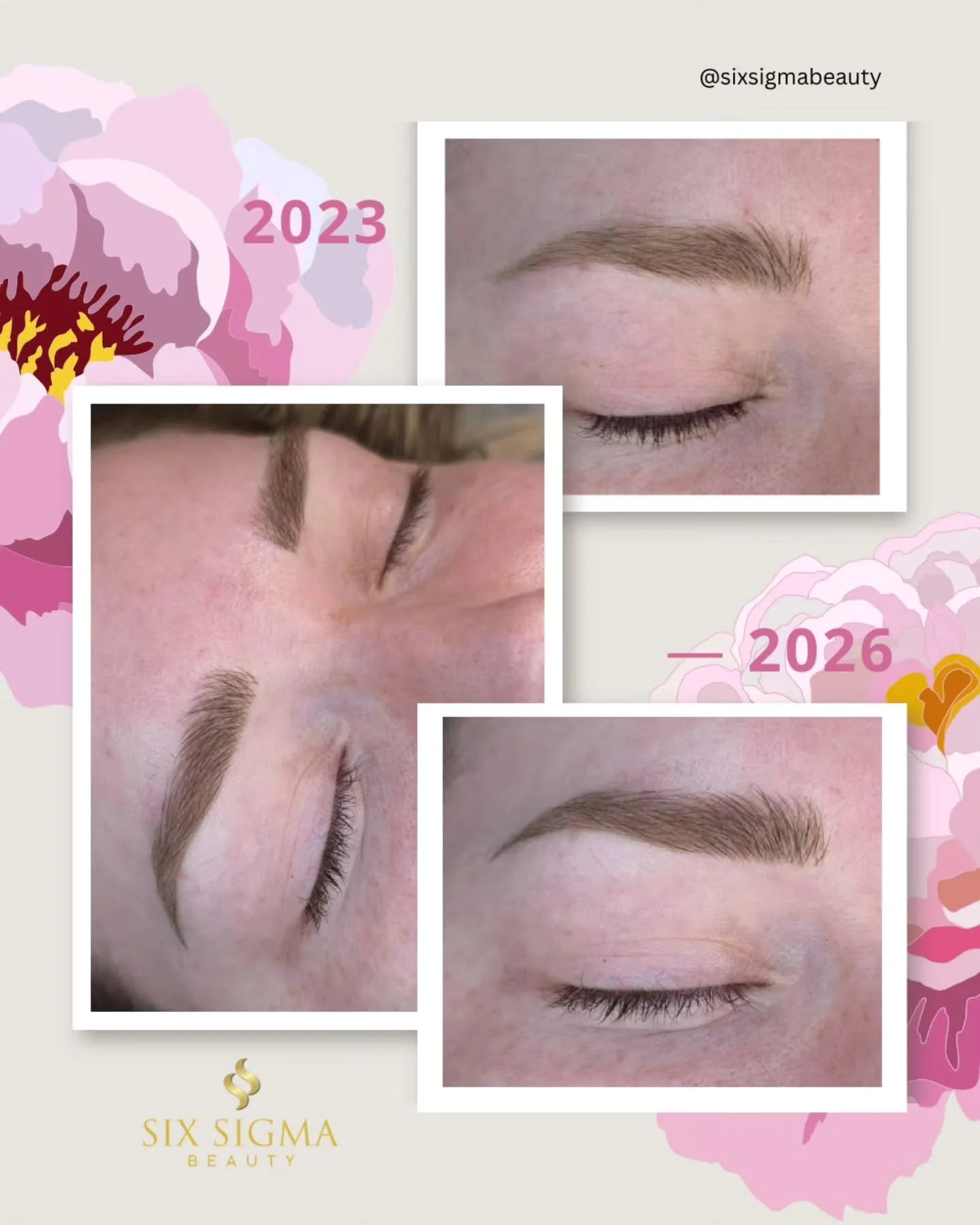 2003 &rarr; 2026. Proof that it's never too late to book your refresh session! 

⭐️⭐️⭐️⭐️⭐️
SIX SIGMA BEAUTY
Boutique Medspa
316 N Main Street, Suite 2
Southington CT 06489
(860) 202-2815 
sixsigmabeauty.com