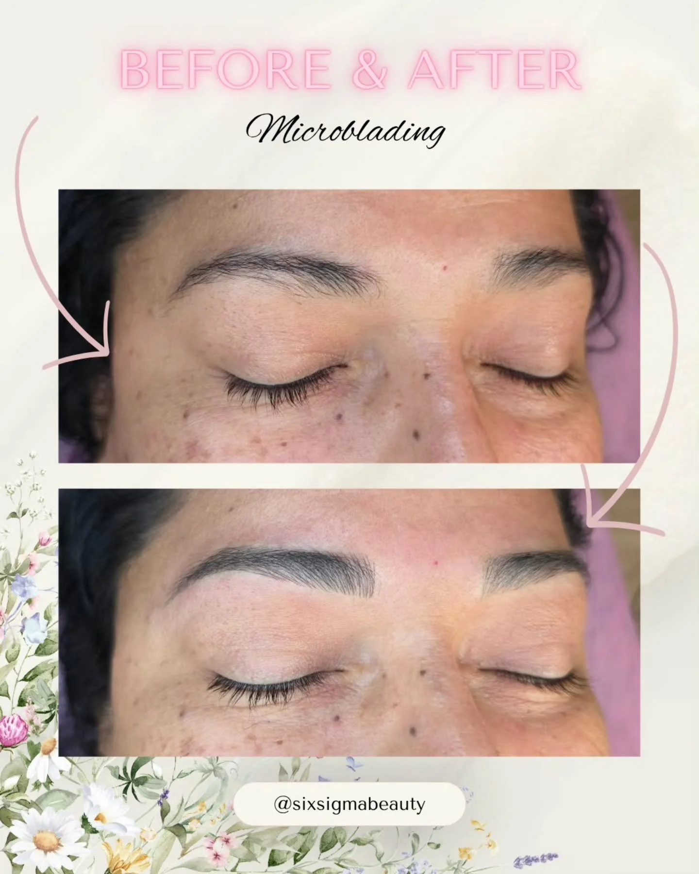 Wake up. Look flawless. Repeat 😍 Say goodbye to filling in your brows every morning - microblading gives you effortless definition 24/7. 

Link in bio to book! ✨️
