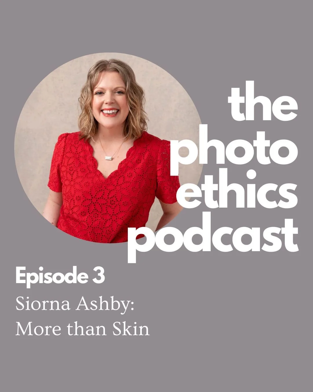 Siorna Ashby: More than Skin