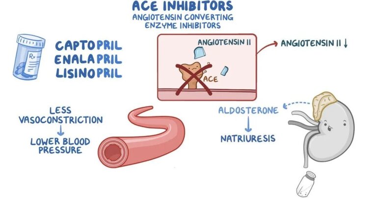 ace inhibitors for blood pressure)