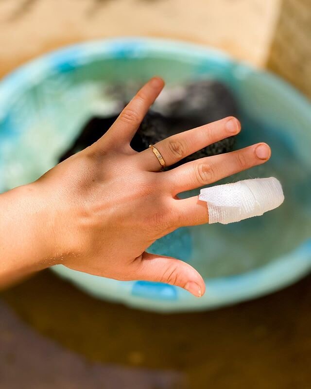 PSA/Update: Cutting off your fingertip is incredibly painful, 10/10 would NOT recommend to a friend. 🤦🏽&zwj;♀️ In all seriousness though, no matter how comfortable you are in the kitchen and with chef&rsquo;s knives, always always always be careful