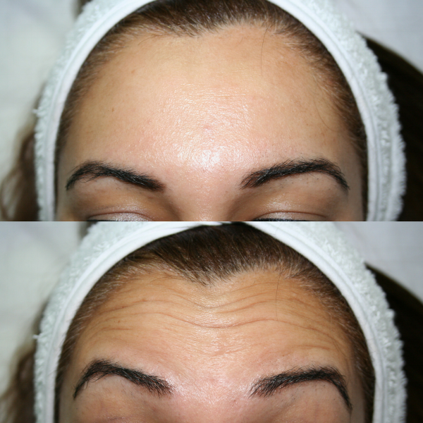All Treatments — Radiance Skincare and Laser Clinic