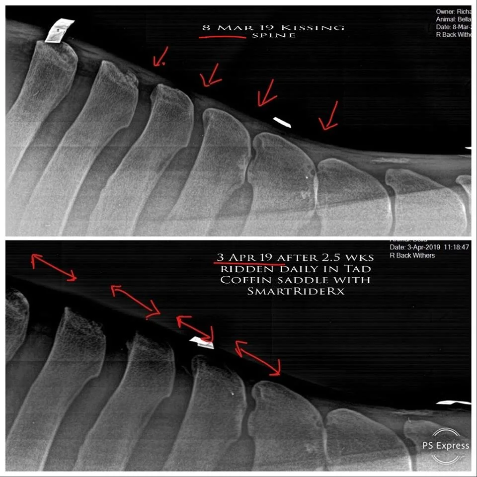 Xray Comparison.jpg