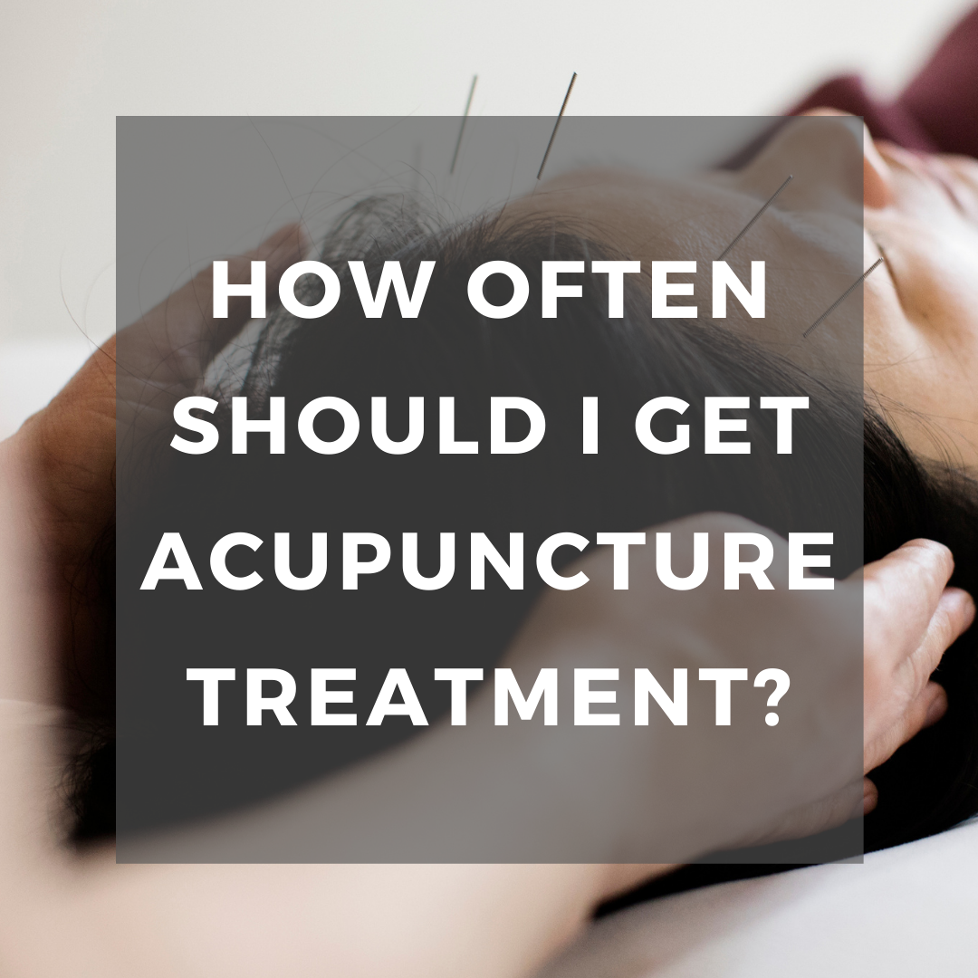 How often should I get acupuncture?