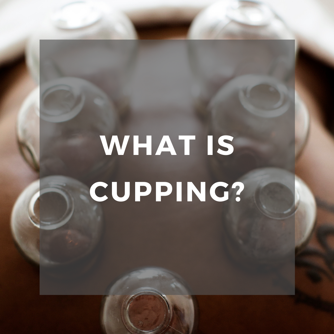 What is cupping?