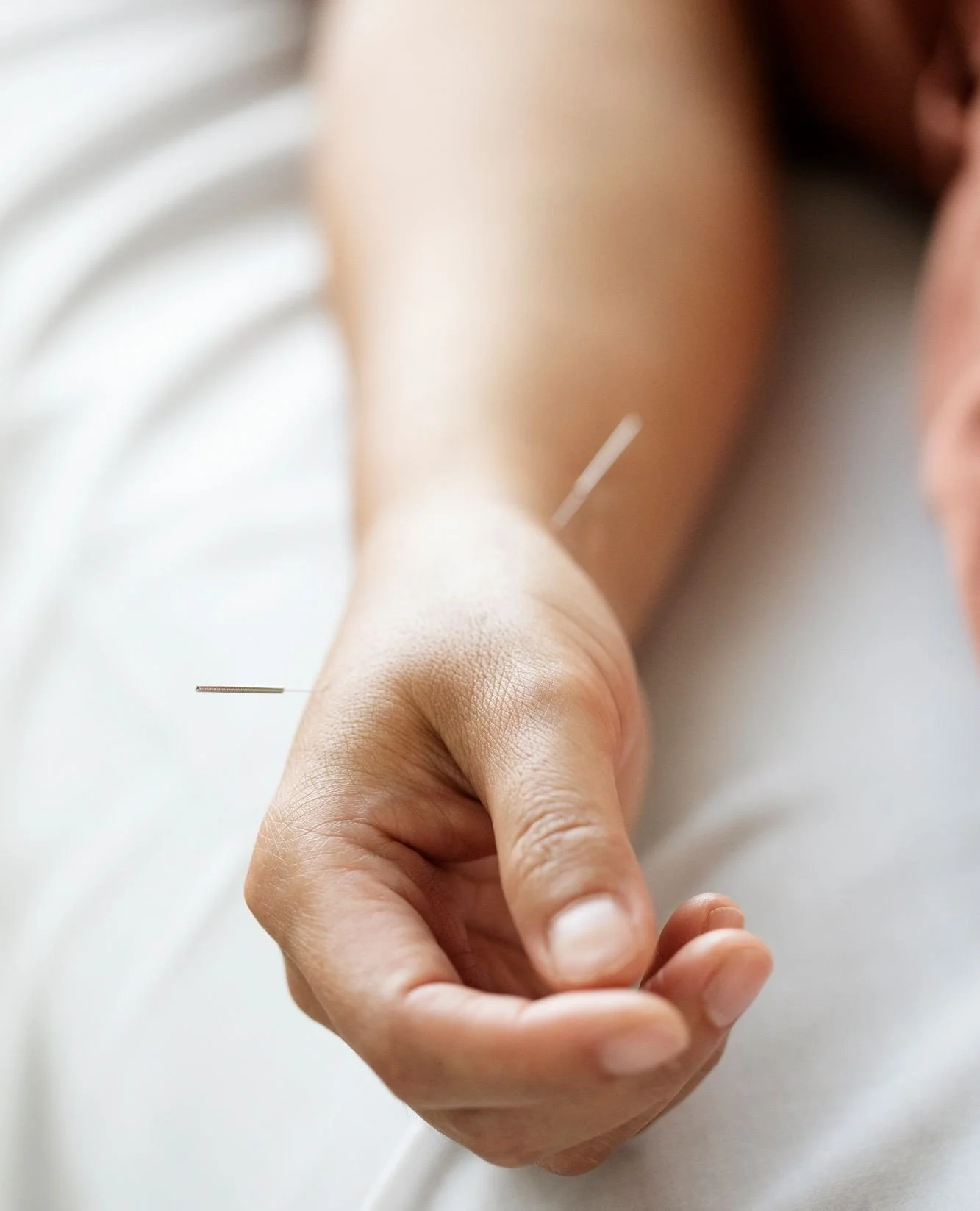 Needle nap (noun) - [NEE-dull NAP]: the sought-after deep relaxation response induced by acupuncture, which is believed to facilitate the body&rsquo;s natural healing processes. ⁠
⁠
This calm and sleepy state is often paired with a light sleep or med