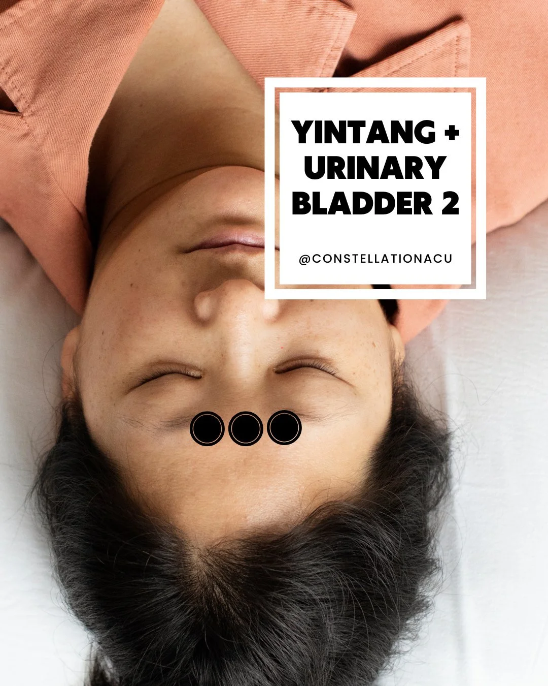 Between colds and the start of season allergies, our clinic has been seeing a lot of patients with sinus pressure and pain recently! Lucky for them, acupuncture is amazing at clearing up congestion and sinus pressure. ⁠
⁠
Self applied acupressure is 