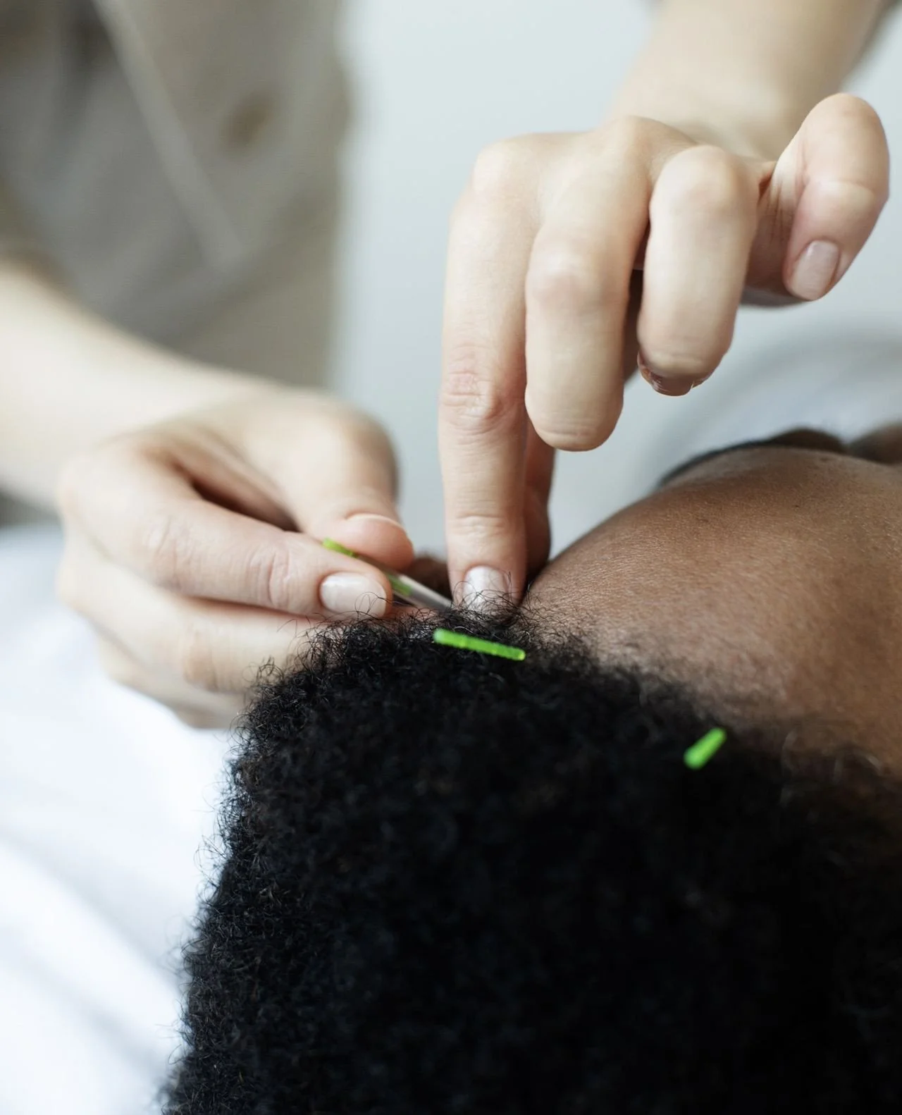 Acupuncture can help you feel better now and in the future.⁠
⁠
We know what it&rsquo;s like to feel frustrated by what may seem like a totally random assortment of symptoms. ⁠
⁠
🕸️ The beauty of Chinese medicine is that we look at your whole self - 
