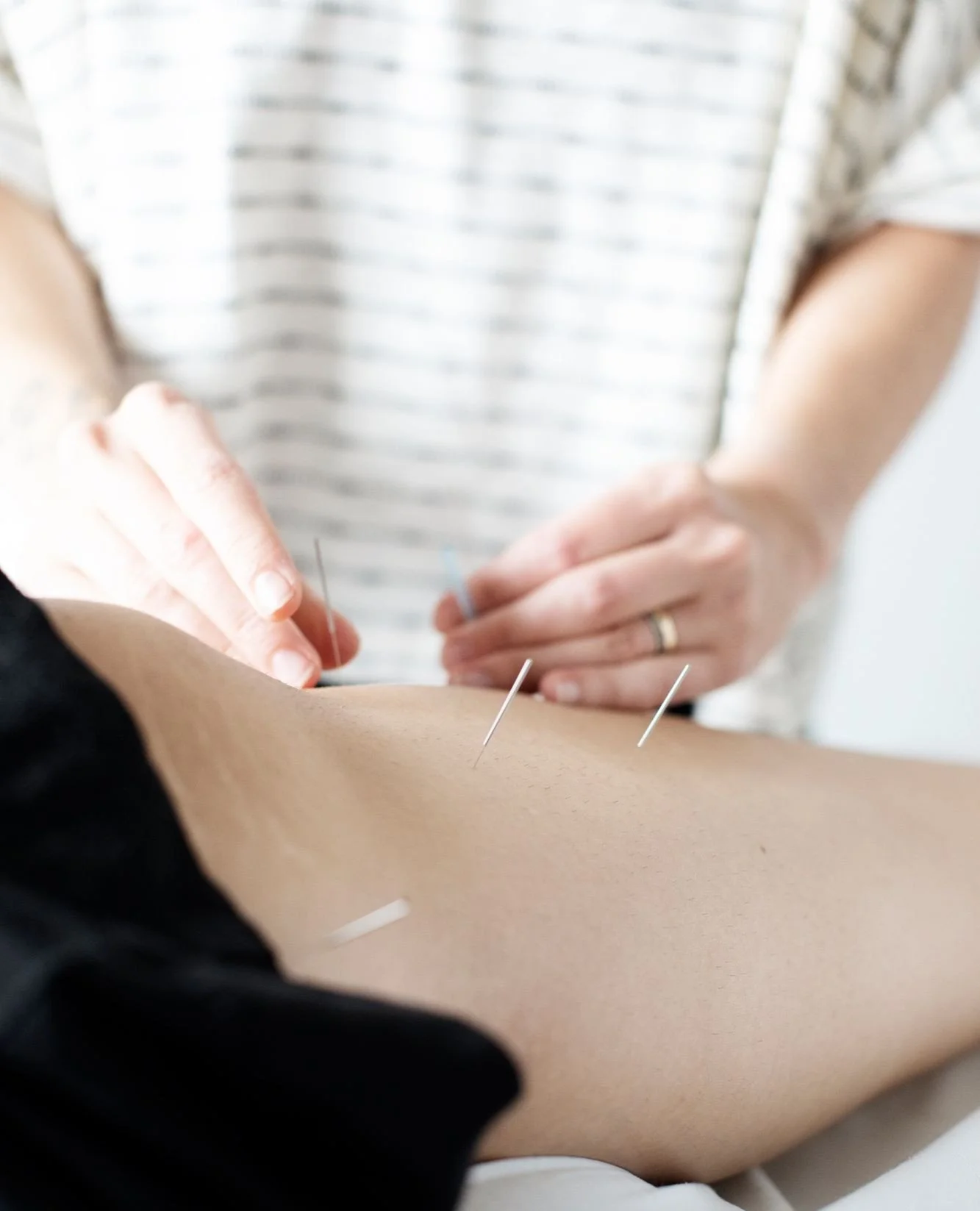 Many patients visit our clinic as a last ditch effort for their health. They've seen their primary physician and one or many specialists before they decide to give acupuncture a shot.

By this time, symptoms may have been present anywhere between 6 m
