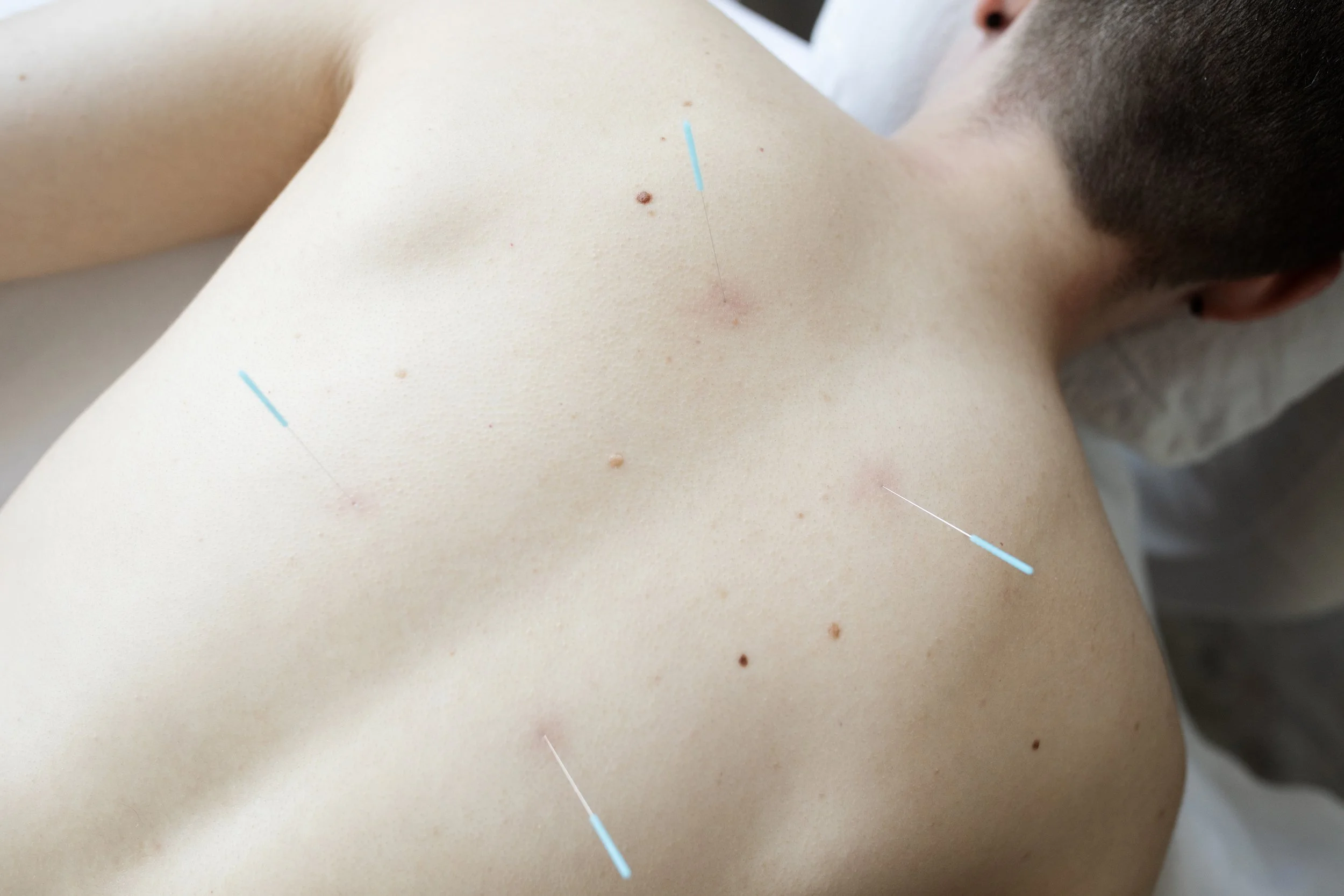 Constellation_Acupuncture_2025_0194.jpg