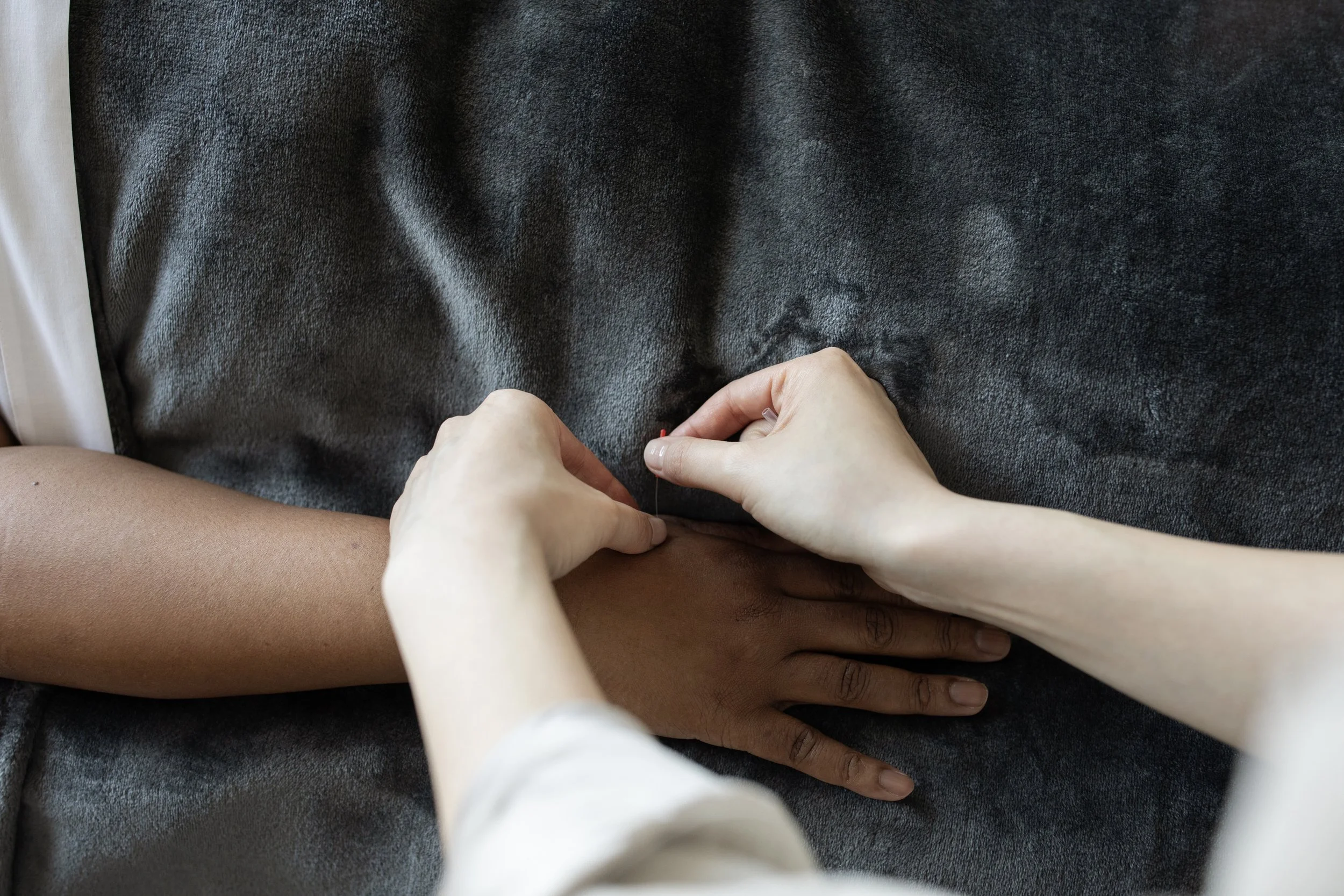 An acupuncturist with light skin inserts a small acupuncture needle into the hand of a patient with dark skin. The patient is rest on a treatment table, covered with a grey fuzzy blanket.