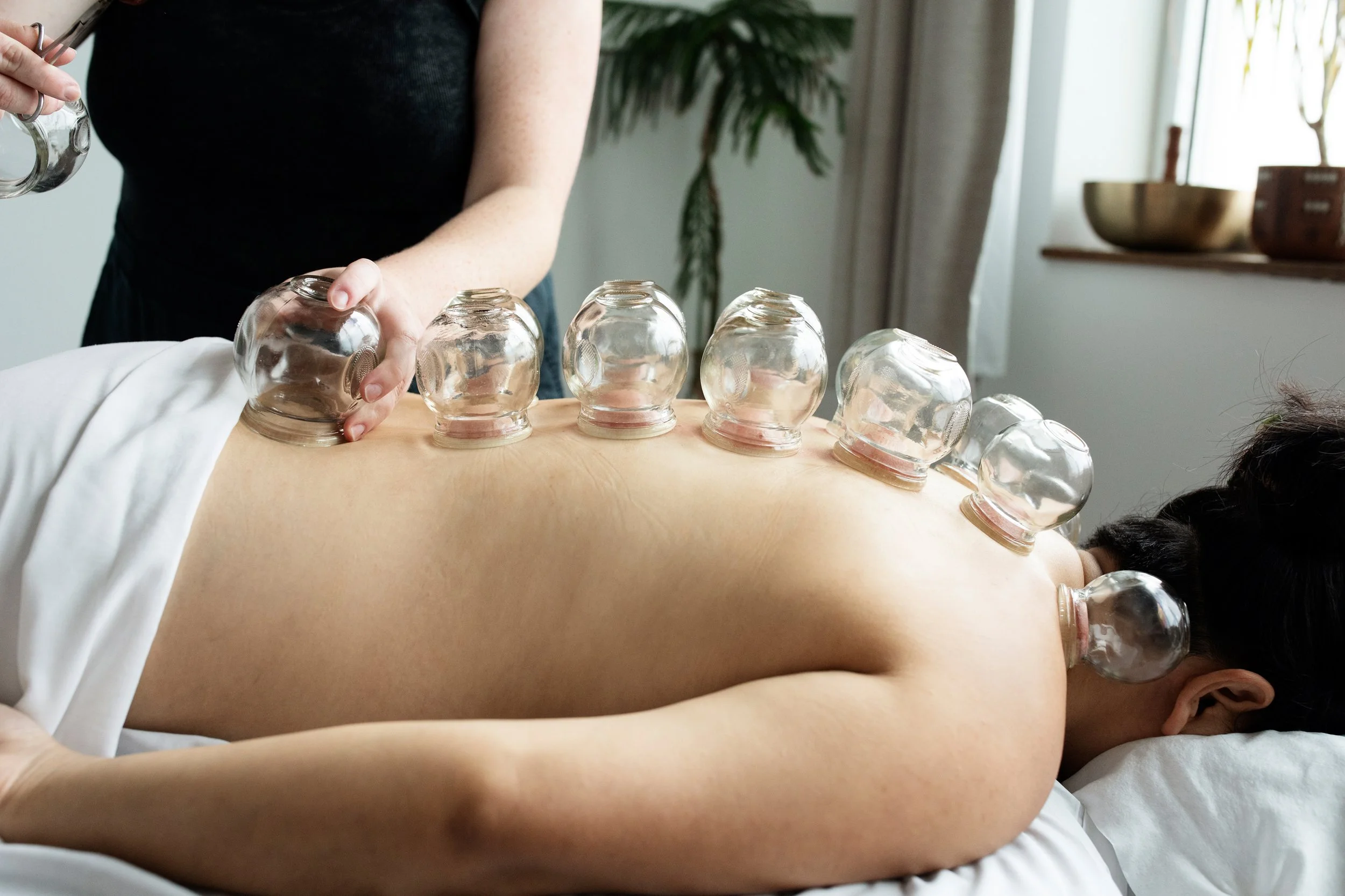 Constellation_Acupuncture_22_0144.jpg