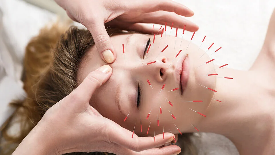 Can-acupuncture-mend-a-broken-heart