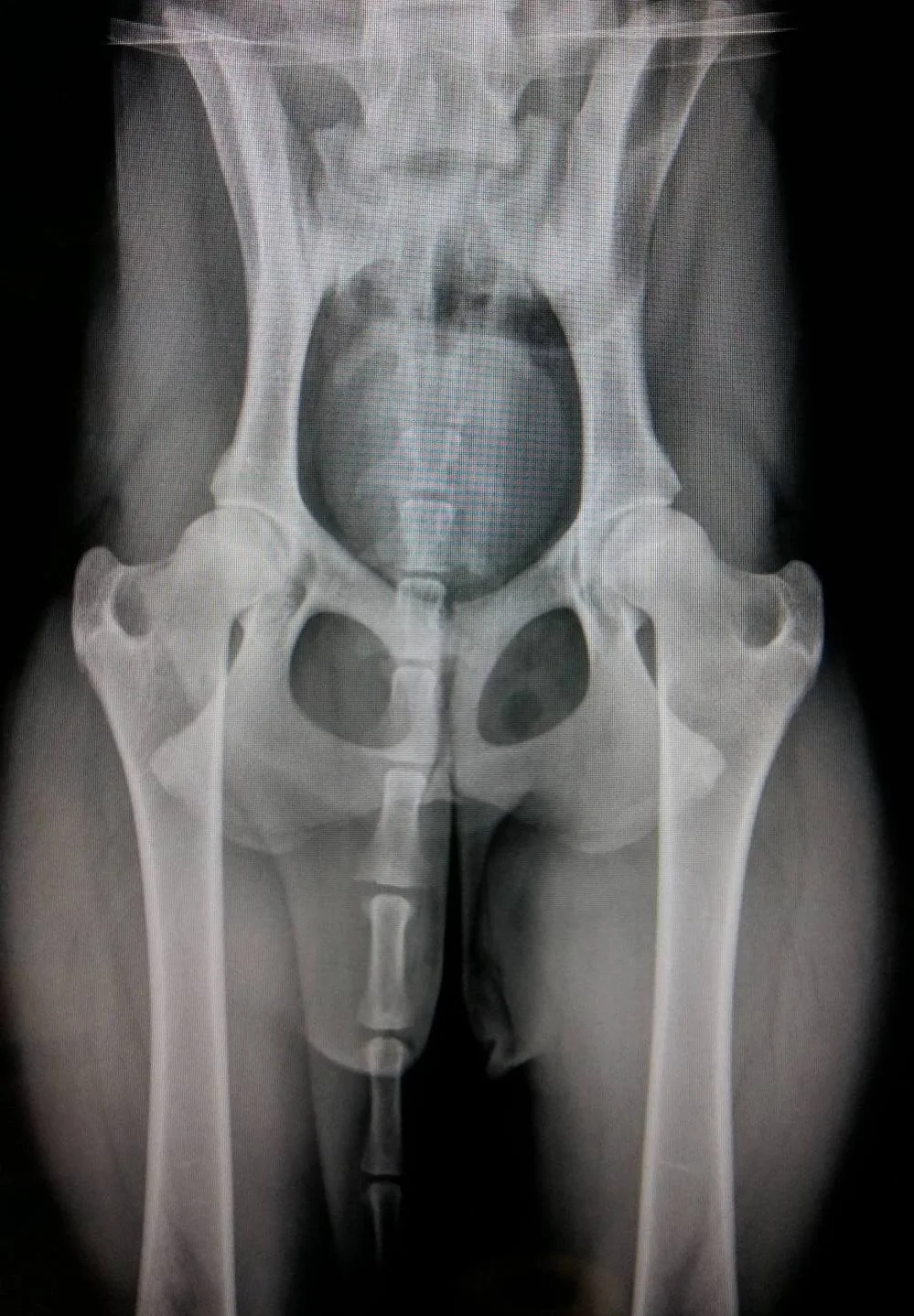 Digital Hip X-rays