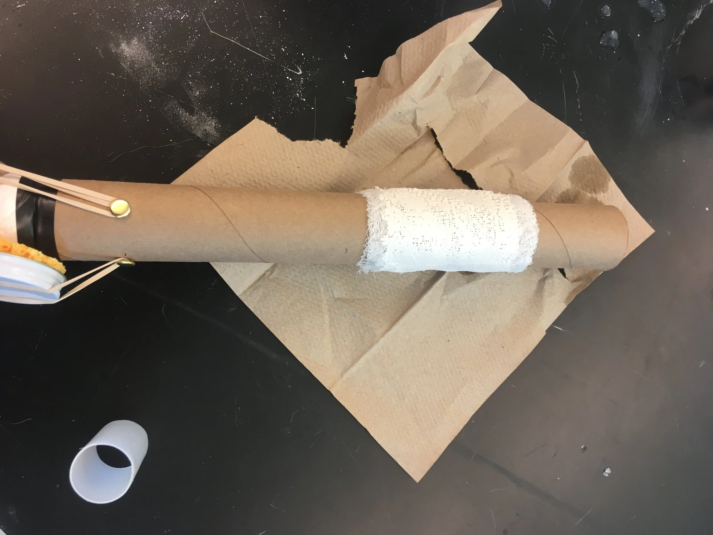 patient_s leg in cast.JPG